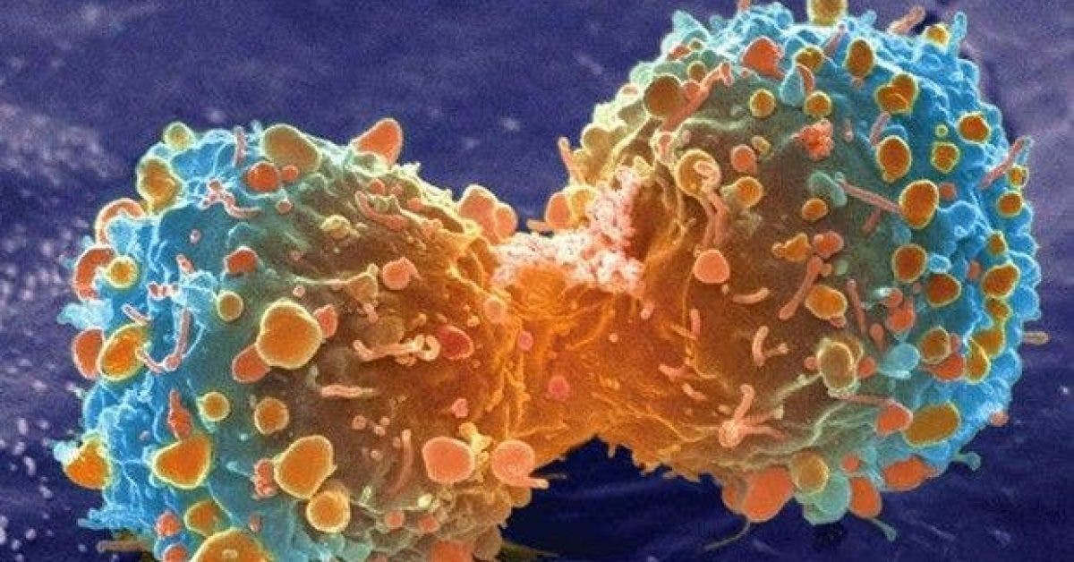 10 aliments puissants qui peuvent prevenir le cancer et empecher la croissance des cellules cancereuses 1