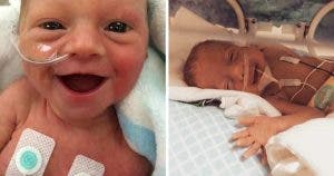 10 photos de bébés prématurés qui sourient parce qu’ils sont heureux d’avoir survécu