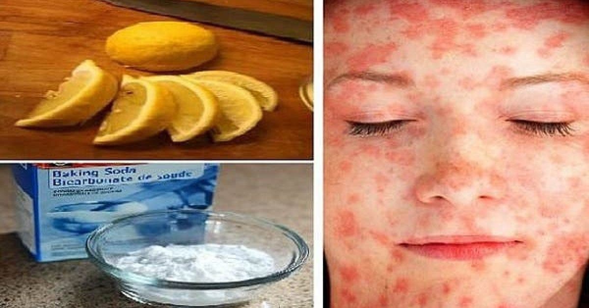 10 produits courants qui detruisent votre peau vous serez completement decu par le 9 1