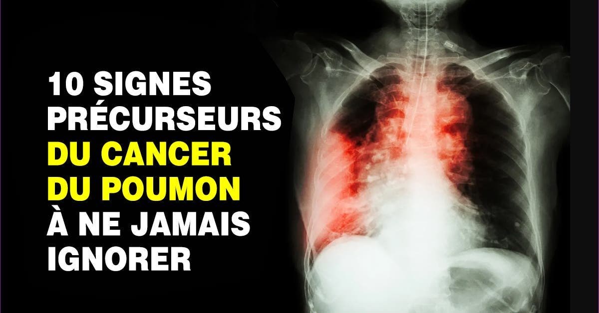 10 signes precurseurs du cancer du poumon que vous devriez connaitre 1
