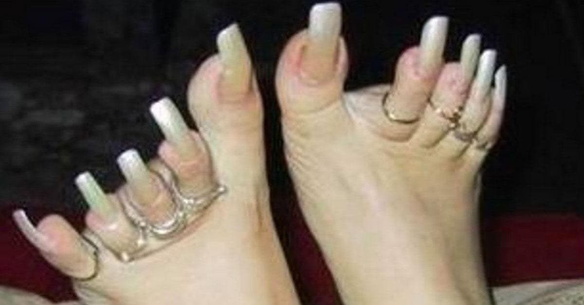 12-photos-des-pires-pieds-au-monde