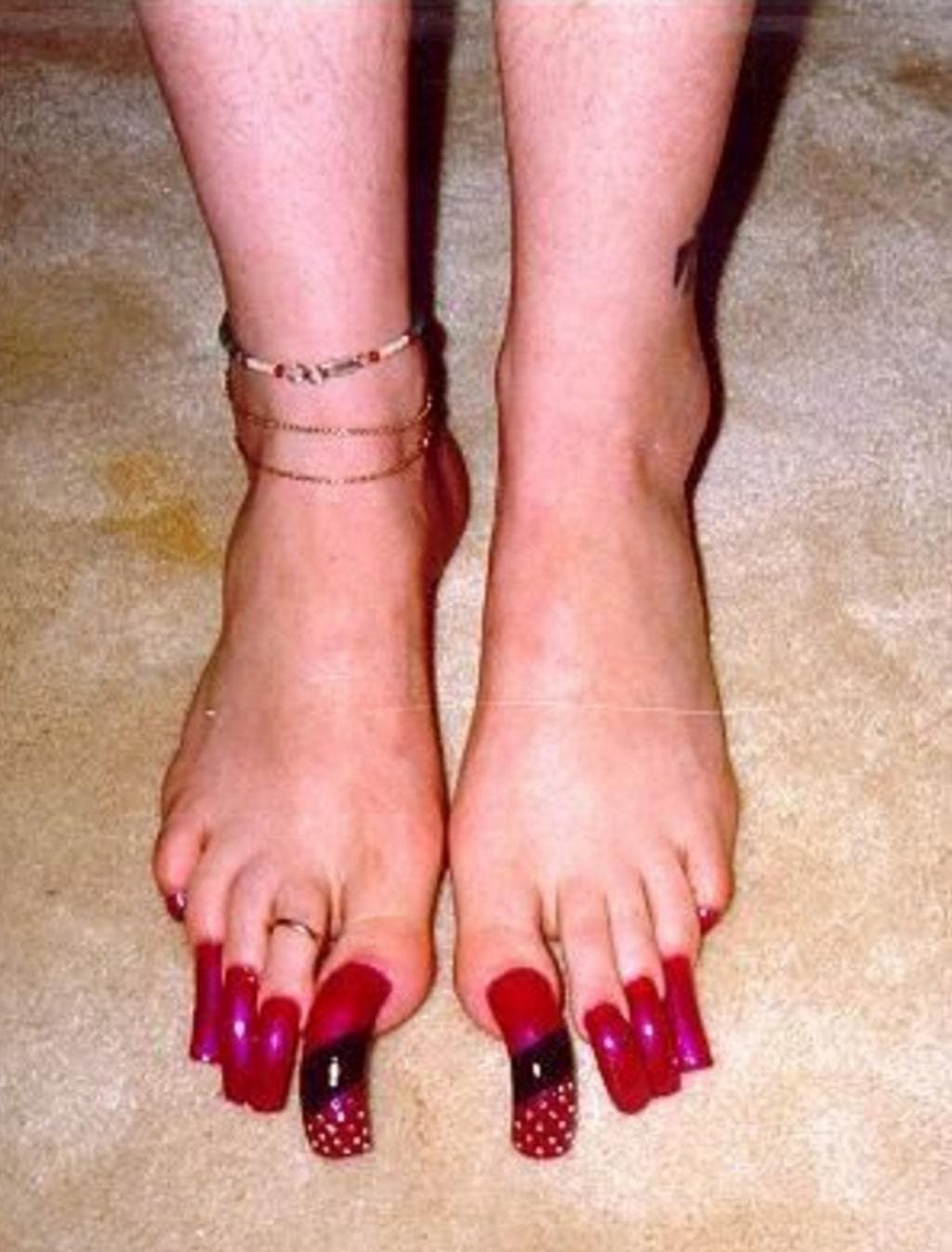 12 pires pieds au monde 1