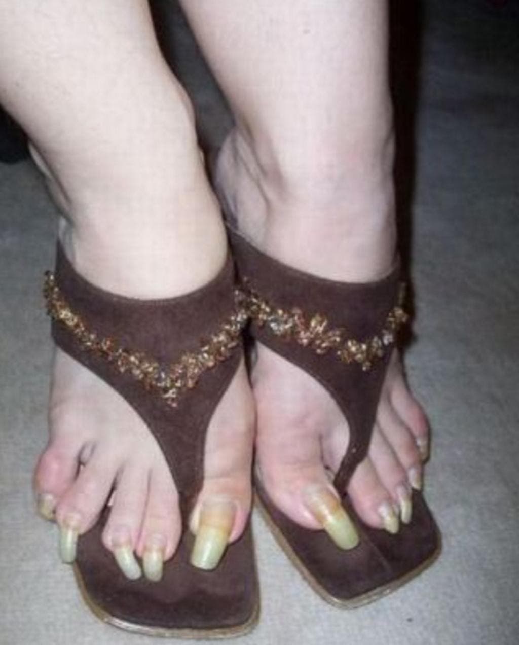 12 pires pieds au monde 12
