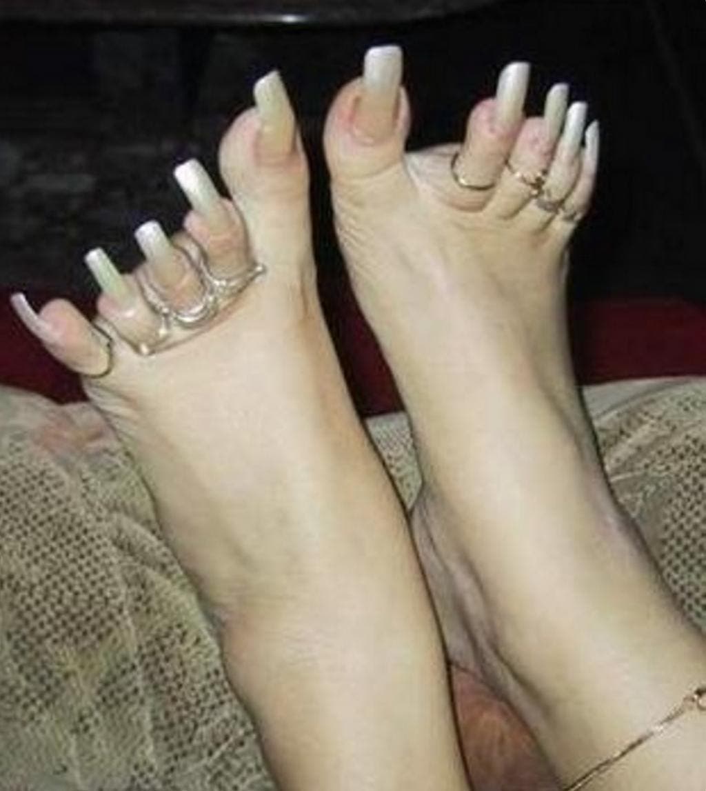 12 pires pieds au monde 2