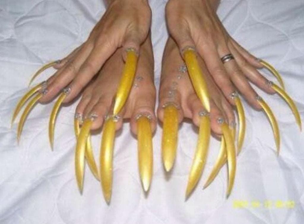12 pires pieds au monde 4