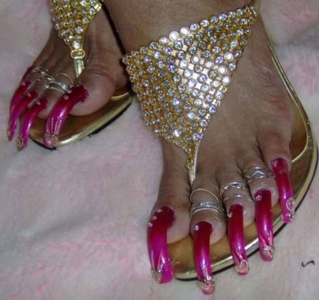 12 pires pieds au monde 5