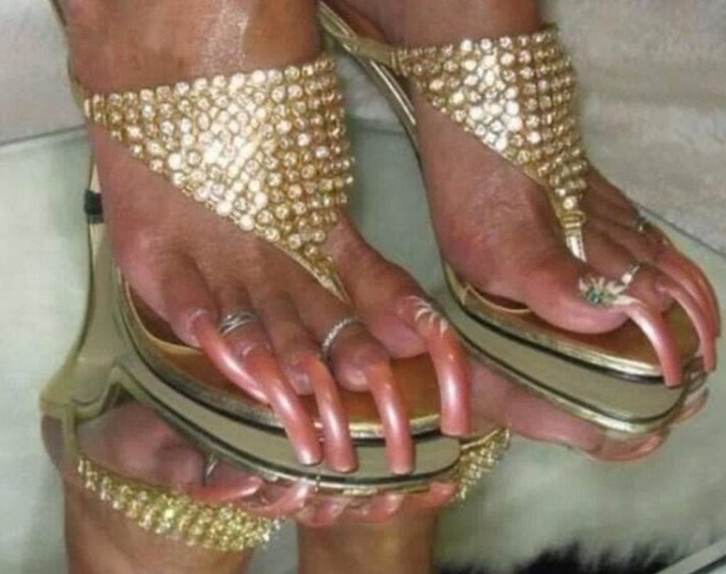 12 pires pieds au monde 6