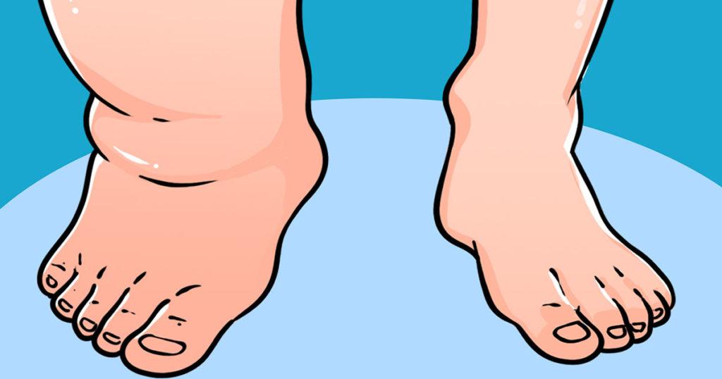 Comment utiliser le bicarbonate de soude contre les poux