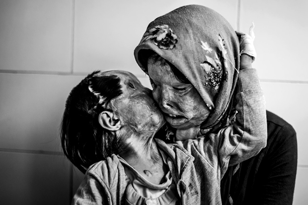 Une mère et son enfant de 3 ans brûlées
