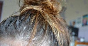 3 problemes de cheveux qui indiquent des problemes de sante 1