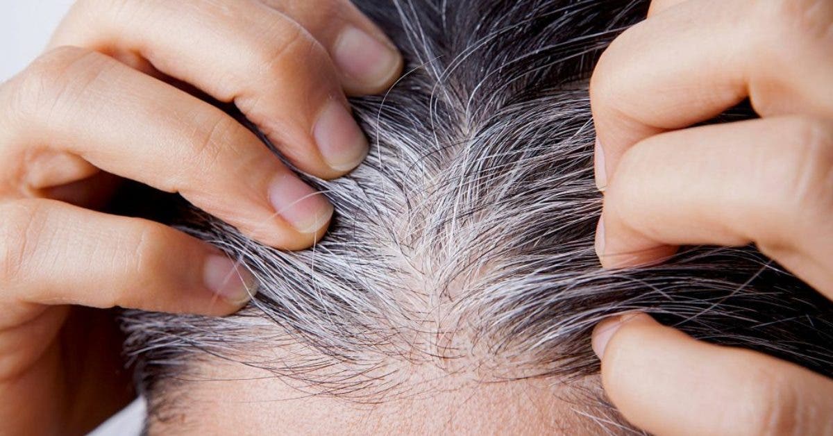 4 astuces efficaces pour couvrir les cheveux blancs sans abîmer votre chevelure