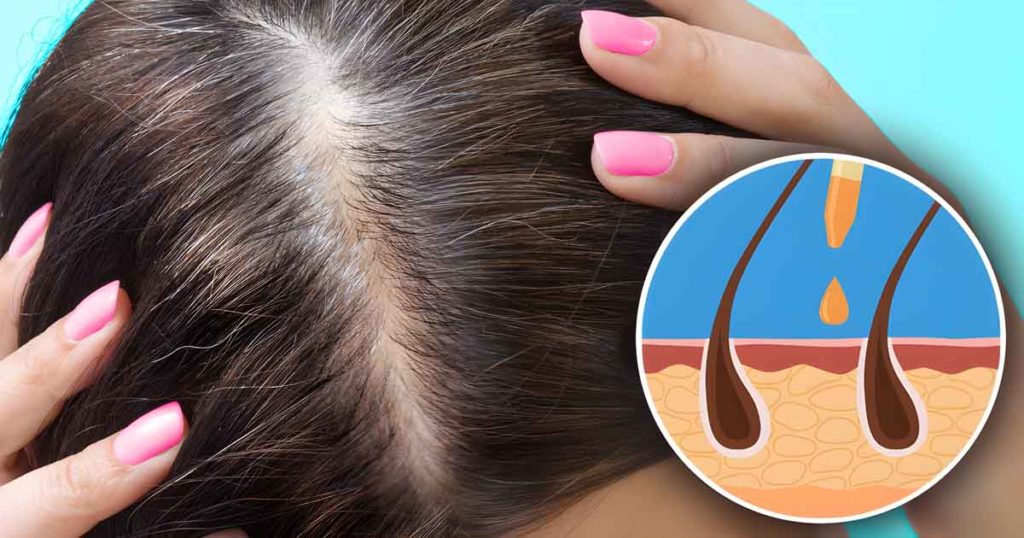 4 astuces naturelles pour couvrir les cheveux blancs sans coloration