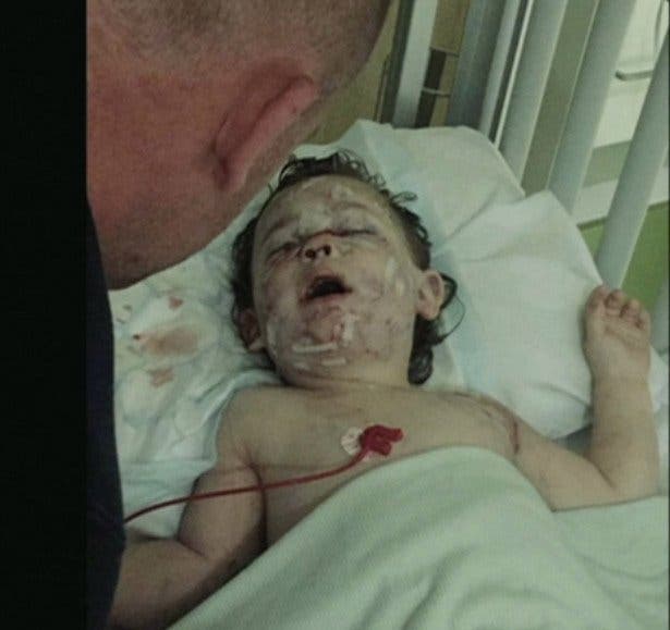 Pitbulls attaquent sauvagement une petite fille de 2 ans sans défenses 