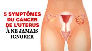 SYMPTÔMES DU CANCER DE L’UTERUS À NE JAMAIS IGNORER