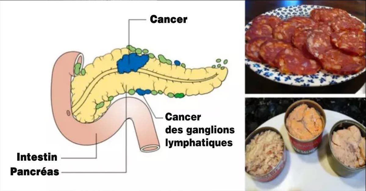 5 aliments cancerogenes que vous ne devriez plus mettre dans votre bouche 1