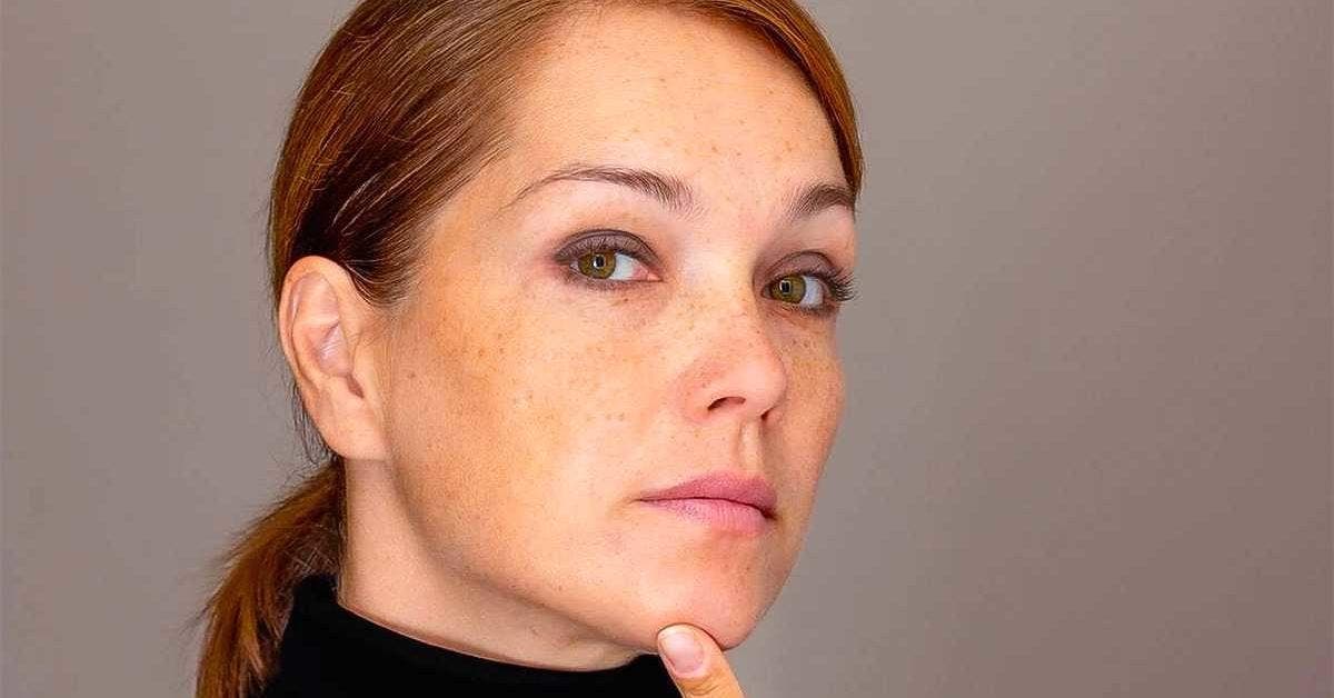 5 astuces de grand-mère pour atténuer les taches brunes sur le visage