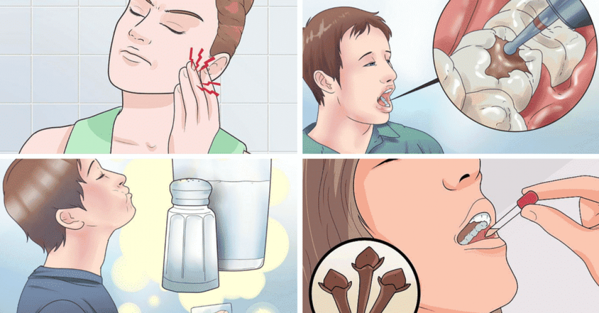 5 astuces naturelles pour se debarrasser des douleurs dentaires naturellement 1