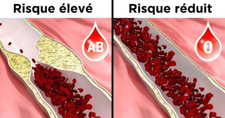 6 choses à savoir sur vous si vous êtes du groupe sanguin O