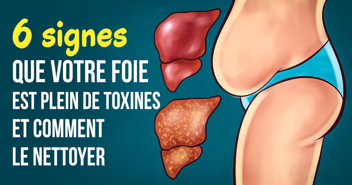 Toxine foie symptomes,