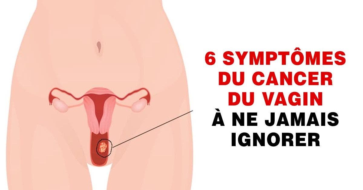 Voici les 6 signes du cancer du vagin