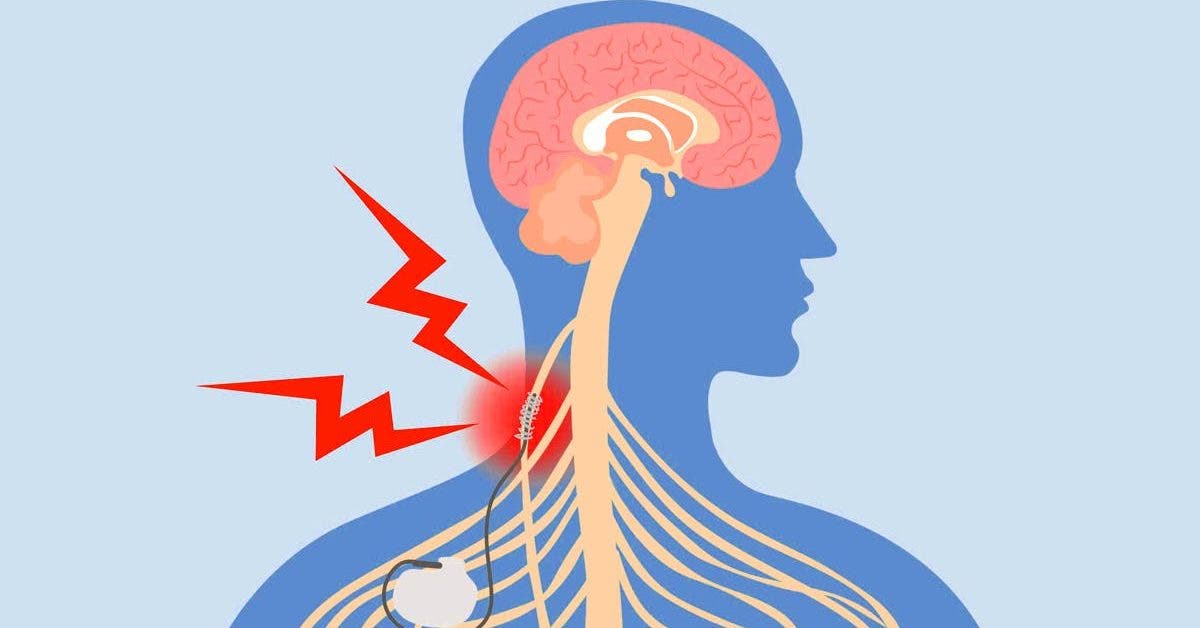 7-facons-de-stimuler-votre-nerf-vague-pour-soulager-linflammation-la-depression-les-migraines-et-plus