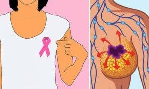 8 signes que le cancer du sein se développe dans votre corps