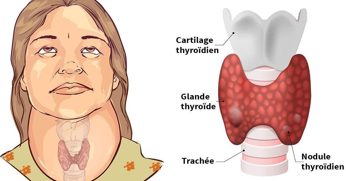 signes qui peuvent révéler un dérèglement de la thyroïde