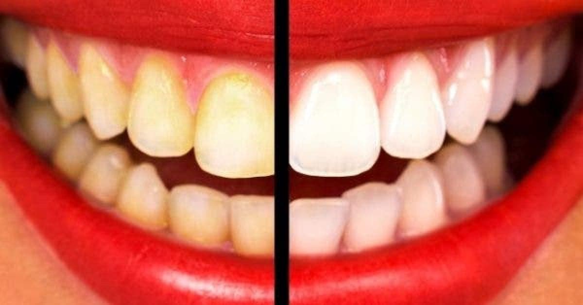 Blanchissez vos dents jaunes en moins de 2 minutes