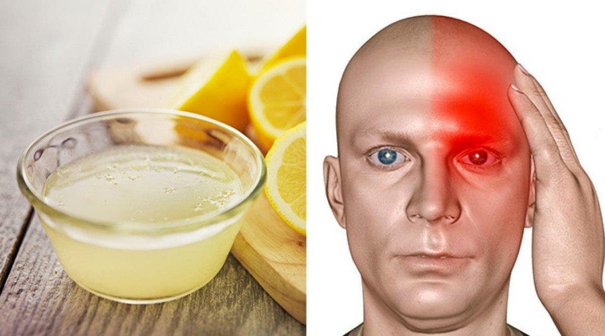 Un remède au sel au citron pour arrêter instantanément un mal de tête