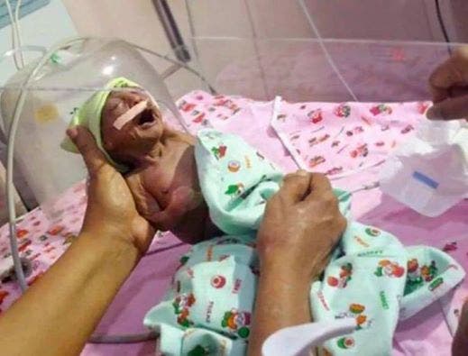 Ce petit bébé a été rejeté par ses parents à la naissance