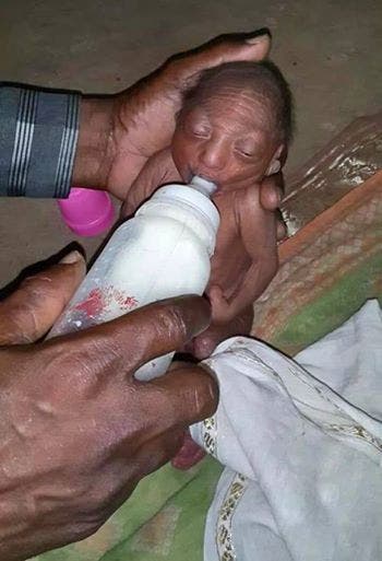 Ce petit bébé a été rejeté par ses parents à la naissance