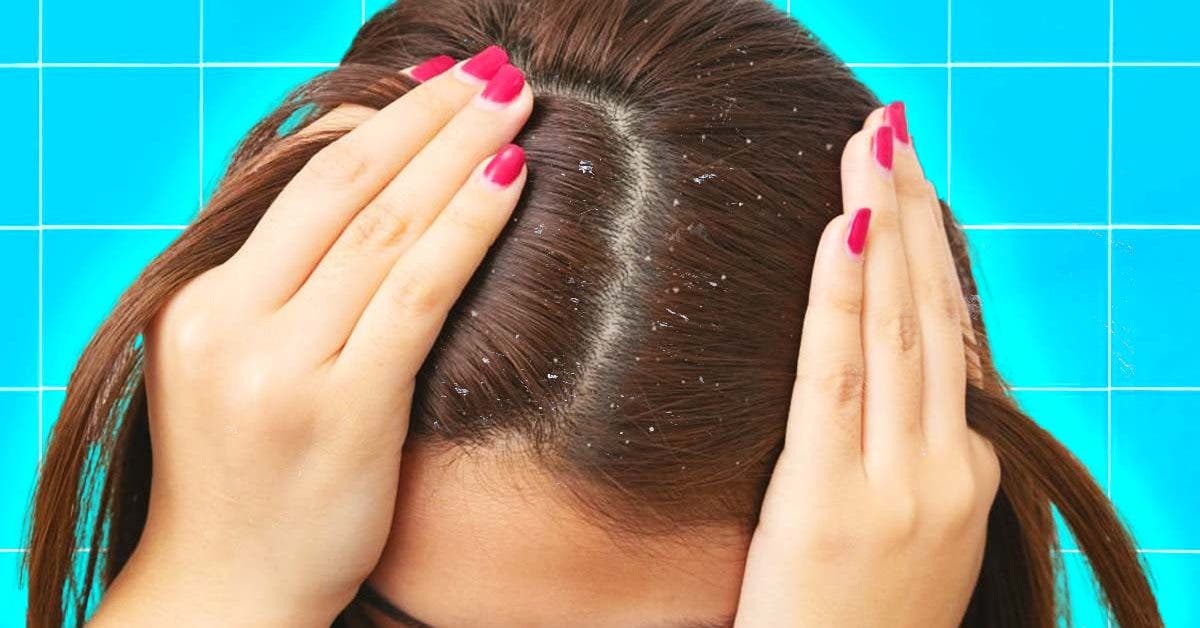Ce que vous devez savoir si vous ne lavez pas vos cheveux pendant une semaine