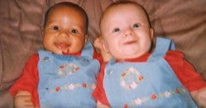 Ces jumelles sont nées avec une couleur de peau différente - 18 ans après, voila à quoi elles ressemblent