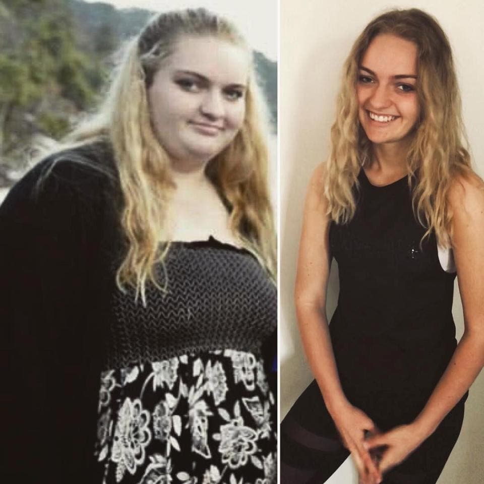 Cette adolescente obèse perd la moitié de son poids corporel en moins d'un an