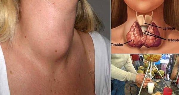 This popular drink destroys your thyroid. Do you consume it?