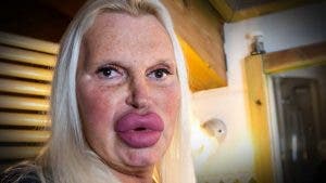 Cette femme a dépensé 46 000 euros en chirurgie pour avoir un visage parfait