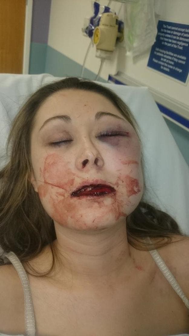 Cette femme a été battu par son petit ami et publie des photos pour dénoncer la violence contre les femmes