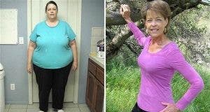 Cette femme a perdu 102 kilos a lage de 63 ans en suivant ces 7 etapes 1