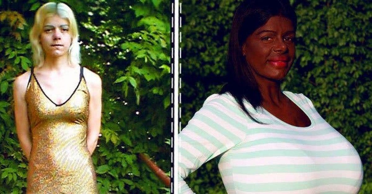 Cette femme allemande a depense des milliers deuros pour devenir noire et se dit africaine