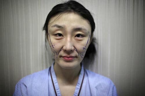 Cette femme de 50 ans a subi 40 chirurgies plastiques pour l’air d’avoir 20 ans
