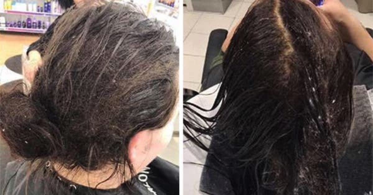Cette femme ne s’est pas lavé les cheveux pendant 6 mois – personne n’aurait imaginé les résultats !