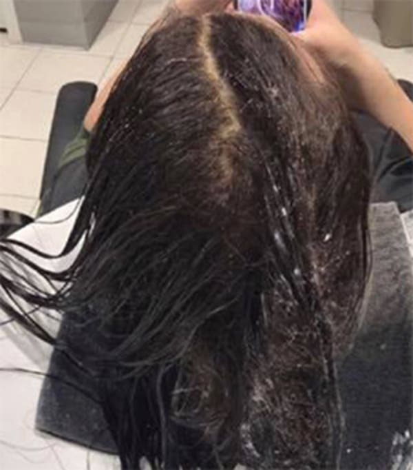 Cette femme ne sest pas lave les cheveux pendant 6 mois2 1