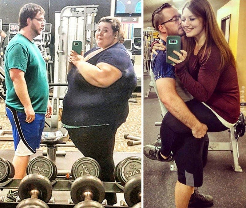 Cette femme souffrant d’obésité a perdu 141 kilos