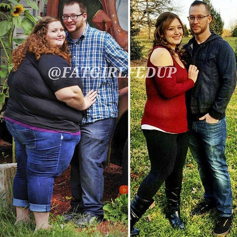 Cette femme souffrant d’obésité a perdu 141 kilos