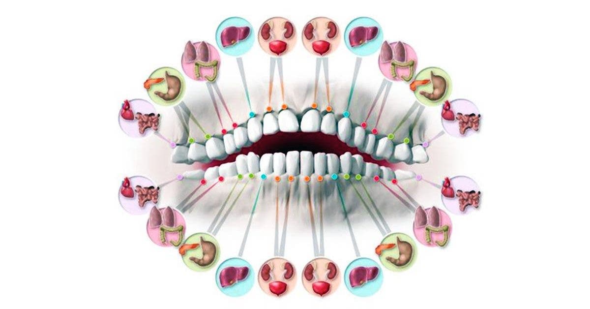 Chacune des dents est reliée à un organe et chaque douleur indique un problème de santé