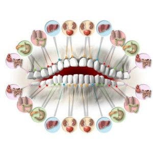 Chaque dent est reliée à un organe et chaque douleur peut indiquer un problème de santé