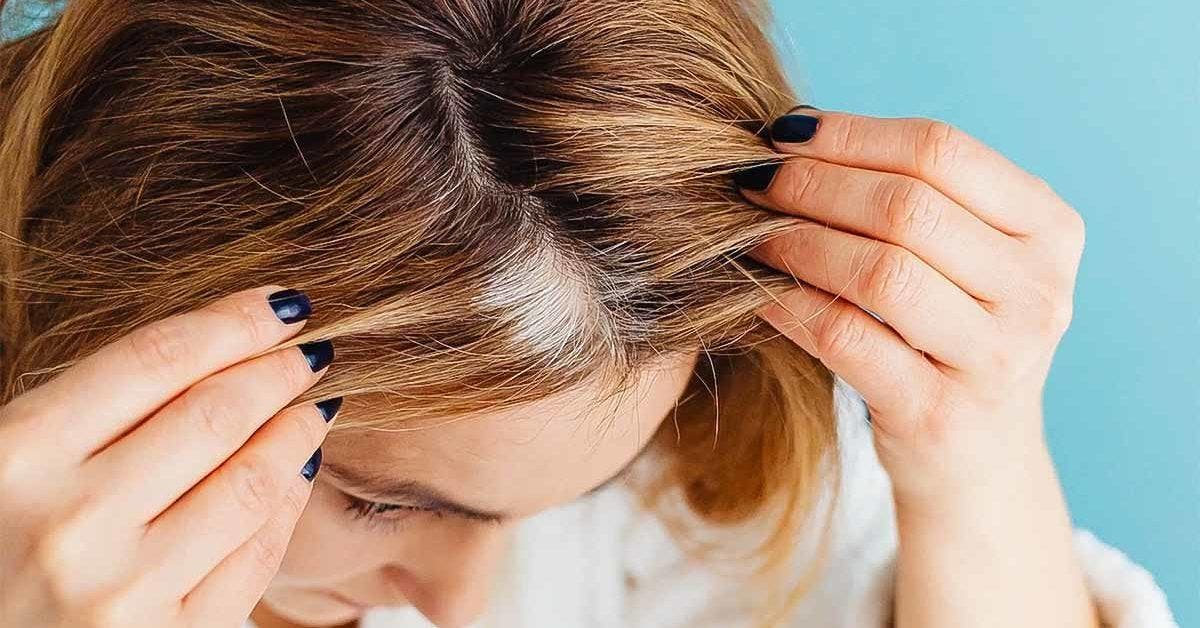 Cheveux gris - 5 astuces pour s'en débarrasser