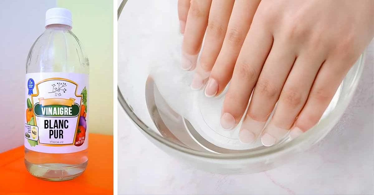 Comment avoir les ongles sains et beaux avec du vinaigre