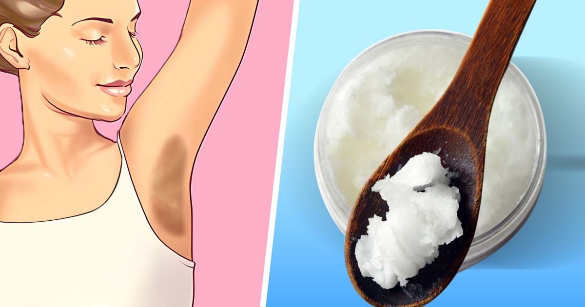 Éclaircir les aisselles : 7 astuces naturelles pour avoir un effet