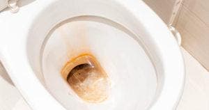 Comment enlever les traces de calcaire au fond des toilettes pour leur donner un aspect comme neuf
